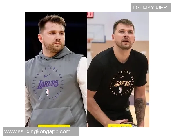 浓眉体重增加近7公斤球探和教练担忧其移动能力下降